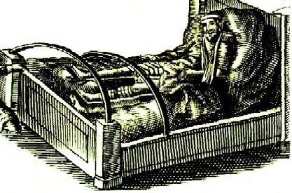 fracture_protecting_legs_from_movement_table_27_jonas_arnold_delineavi_armamentarium_chirurgicum_bipartitum_Johannes_Scultetus_1666_p68